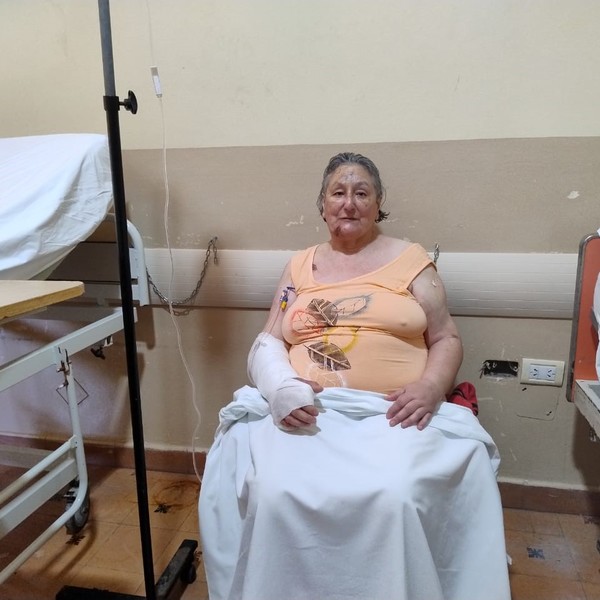 Murió la única sobreviviente del colapso del hotel Dubrovnik en Villa&nbsp;Gesell