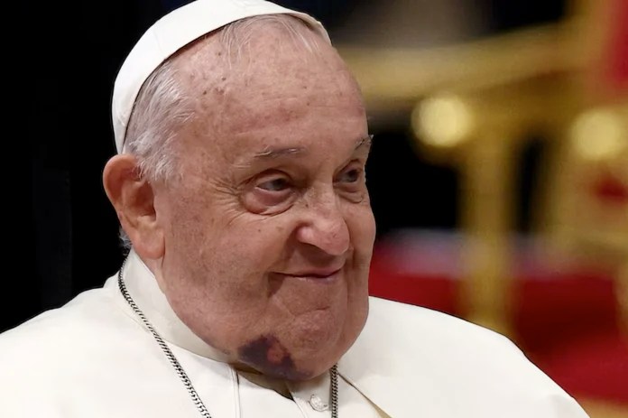 El Papa Francisco se mostró con un moretón en el&nbsp;rostro
